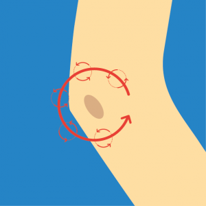 Beispiel für NOVAFON Anwendung bei bursitis Beispiel für NOVAFON Anwendung bei bursitis