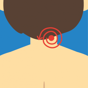 Beispiel für NOVAFON Anwendung bei myalgie2 Beispiel für NOVAFON Anwendung bei myalgie2
